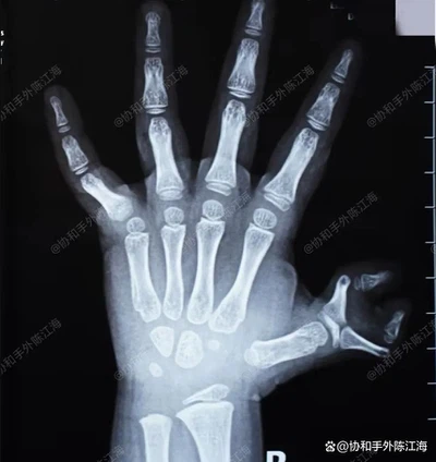 info-858-909 info-858-909